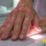 Aplicación de la IA en la Capilaroscopia