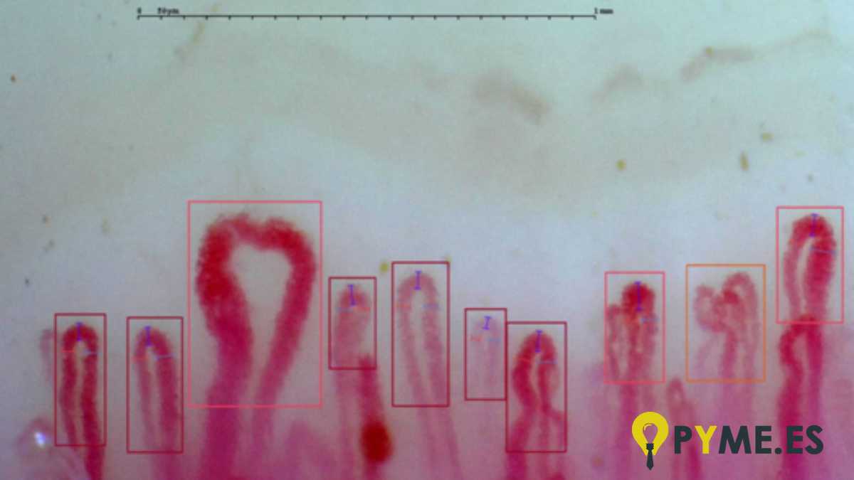 Capilaroscopia con Capillary.io